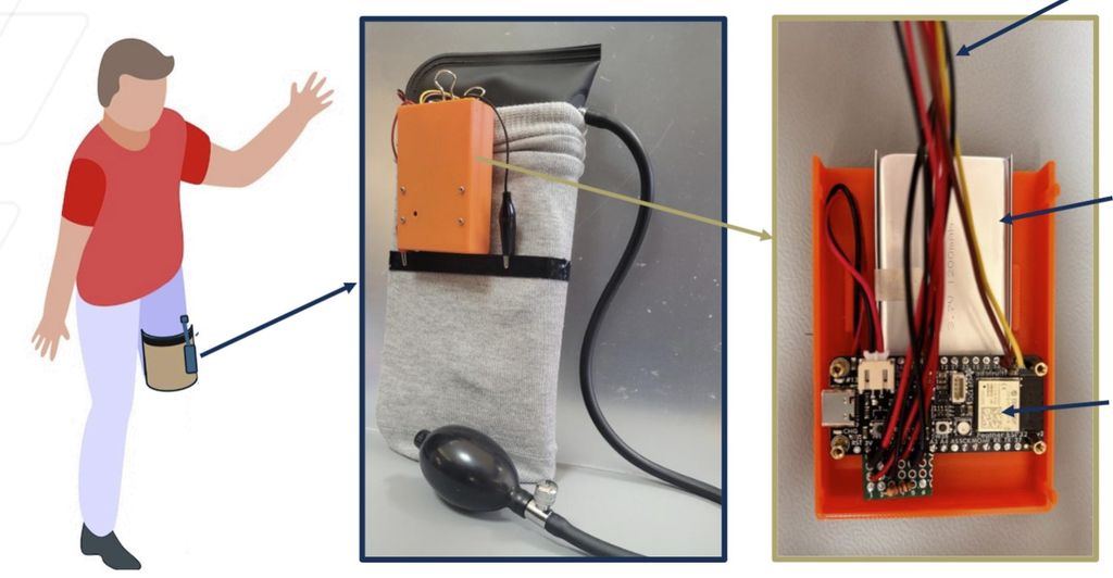 Smart Shrinker Compression Sleeve